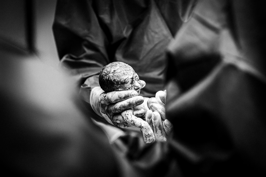 Een baby die met 29 weken middels een keizersnede in het ziekenhuis van Utrecht geboren wordt van Sandrinos Geboortefotografie