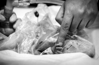 Keizersnede-Utrecht-Sandrinos-Geboortefotografie-3 Keizersnede Utrecht Sandrinos Geboortefotografie