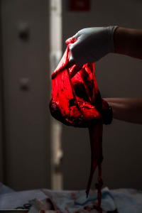 Geboortereportage Den Haag-10 De verloskundige laat de placenta aan de ouders zien na de geboorte