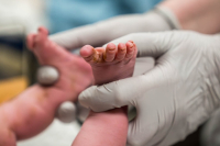 Geboortereportage Den Haag-15 In het HMC in Den Haag kijkt de verloskundige de baby na en test haar op reflexen