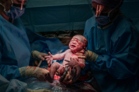 De gynaecoloog laat de baby zien na de geplande keizersnede in RKZ Beverwijk