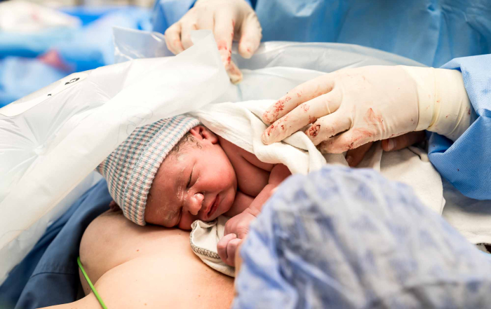 De pasgeboren baby ligt na de keizersnede bij mama op haar borst op de ok