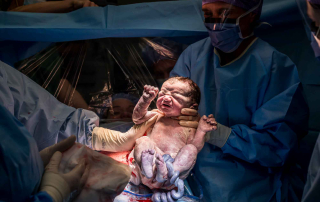 De baby wordt geboren middels een keizersnede in het ziekenhuis in Beverwijk
