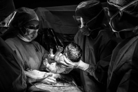 De artsen houden de baby vast tijdens de keizersnede